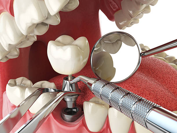 Best Cracked Tooth Emergency Dentist  in Tahlequah, OK